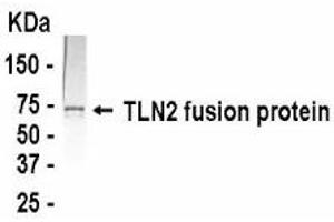 Western Blotting (WB) image for anti-Talin 2 (TLN2) (AA 1750-1950) antibody (ABIN2467893)
