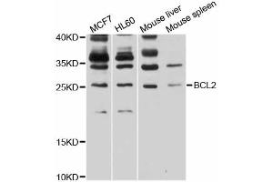 Western blot analysis of extracts of various cell lines, using BCL2 antibody (ABIN6291793) at 1:1000 dilution.