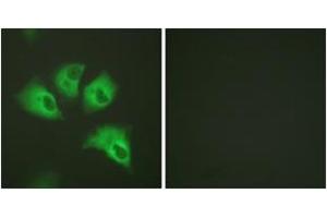Immunofluorescence analysis of HeLa cells, using Kir5. (KIR5.1 antibody  (pSer417))