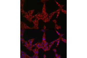 Immunofluorescence analysis of PC-12 cells using GSDME antibody (ABIN6127757, ABIN6139554, ABIN6139555 and ABIN6223304) at dilution of 1:50. (Non-Syndromic Hearing Impairment Protein 5 (GSDME) (AA 1-260) antibody)