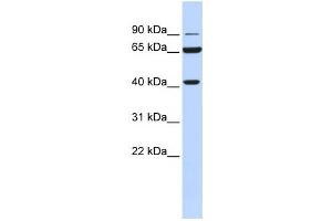 Western Blotting (WB) image for anti-Glucose-6-Phosphate Dehydrogenase (G6PD) antibody (ABIN2459470) (Glucose-6-Phosphate Dehydrogenase antibody)