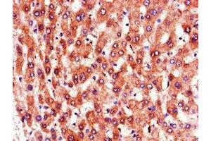 Immunohistochemistry of paraffin-embedded human liver tissue using ABIN7164866 at dilution of 1:100 (PTGR1 antibody  (AA 202-282))