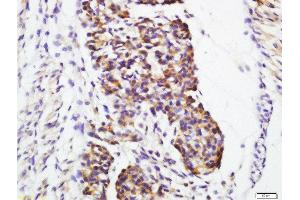 Formalin-fixed and paraffin embedded mouse embryo labeled with Rabbit Anti-Galectin 1 Polyclonal Antibody, Unconjugated (ABIN718586) at 1:200 followed by conjugation to the secondary antibody and DAB staining (LGALS1/Galectin 1 antibody  (AA 65-135))