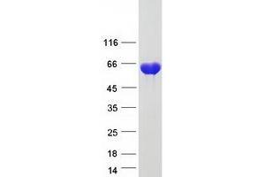 Validation with Western Blot