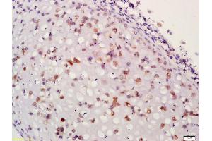 Formalin-fixed and paraffin embedded mouse embryo labeled with Anti-Aggrecan1 Polyclonal Antibody, Unconjugated (ABIN673599) at 1:200 followed by conjugation to the secondary antibody and DAB staining (Aggrecan antibody  (AA 101-220))