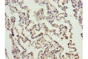 ERCC6L2 antibody  (AA 72-371)