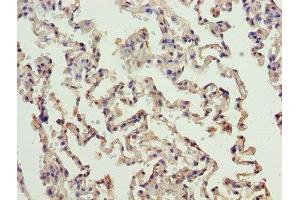 Immunohistochemistry of paraffin-embedded human lung tissue using ABIN7150172 at dilution of 1:100 (ERCC6L2 antibody  (AA 72-371))