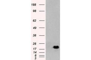 HEK293T cells were transfected with the pCMV6-ENTRY control (Left lane) or pCMV6-ENTRY AK1 (Right lane) cDNA for 48 hrs and lysed. (Adenylate Kinase 1 antibody)