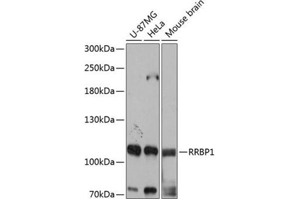 RRBP1 抗体  (AA 1-140)