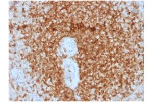 ABIN6383841 to BCL2 was successfully used to stain cells primarily in the germinal centre of human spleen sections. (Recombinant Bcl-2 antibody)
