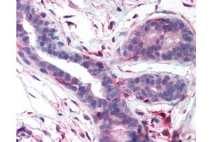 Anti-FAK antibody IHC of human breast. (FAK antibody  (Kinase Domain))