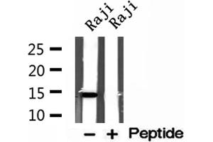 Western blot analysis of extracts of Raji cells, using ISCU antibody. (ISCU antibody  (Internal Region))