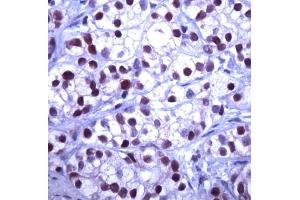 Human prostate stained with anti-SKP2 (SKP2 antibody  (AA 221-425))
