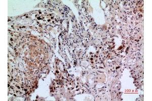 Immunohistochemistry (IHC) analysis of paraffin-embedded Human Lung, antibody was diluted at 1:100. (NFATC1 antibody  (C-Term))