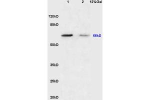 Lane 1: mouse brain lysates Lane 2: mouse lung lysates probed with Anti Sema7A/CD108 Polyclonal Antibody, Unconjugated (ABIN749363) at 1:200 in 4 °C. (SEMA7A antibody  (AA 351-450))