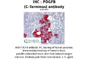 Image no. 1 for anti-Platelet Derived Growth Factor Subunit B (PDGFB) (C-Term) antibody (ABIN1737934) (PDGFB antibody  (C-Term))