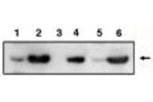 Image no. 1 for anti-Tumor Protein P53 Inducible Protein 3 (TP53I3) antibody (ABIN201595) (TP53I3 antibody)