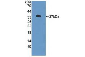 Detection of Recombinant P2RX7, Human using Polyclonal Antibody to Purinergic Receptor P2X, Ligand Gated Ion Channel 7 (P2RX7) (P2RX7 antibody  (AA 47-334))