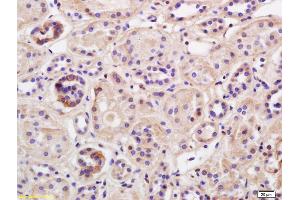 Formalin-fixed and paraffin embedded human kidney labeled with Rabbit Anti TRIM41 Polyclonal Antibody, Unconjugated (ABIN1386953) at 1:200 followed by conjugation to the secondary antibody and DAB staining (TRIM41 antibody  (AA 260-293))