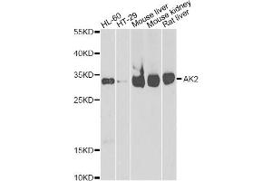 Western blot analysis of extracts of various cell lines, using AK2 antibody (ABIN2560999) at 1:1000 dilution. (Adenylate Kinase 2 antibody)