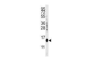 Western blot analysis of anti-CDA Antibody (C-term) (ABIN389393 and ABIN2839485) in mouse kidney tissue lysates (35 μg/lane). (CDA antibody  (C-Term))