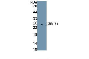 Detection of Recombinant HSPA5, Rat using Polyclonal Antibody to Heat Shock 70 kDa Protein 5 (HSPA5) (GRP78 antibody  (AA 260-469))