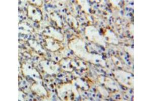 IHC-P analysis of Spleen tissue, with DAB staining. (LAT antibody  (AA 33-227))