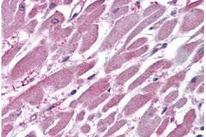 Human Heart: Formalin-Fixed, Paraffin-Embedded (FFPE) (PPP2R1A antibody  (AA 576-589))