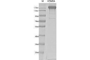 Recombinant JARID1A / KDM5A protein gel.