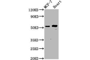 Western Blot Positive WB detected in: MCF-7 whole cell lysate, Rat heart tissue All lanes: NOP53 antibody at 4. (Ribosome Biogenesis Protein NOP53 (NOP53) (AA 227-405) antibody)