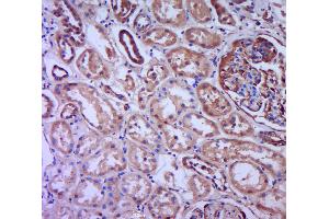 Paraformaldehyde-fixed, paraffin embedded human kidney; Antigen retrieval by boiling in sodium citrate buffer (pH6. (NADPH Oxidase 4 antibody  (AA 201-300))