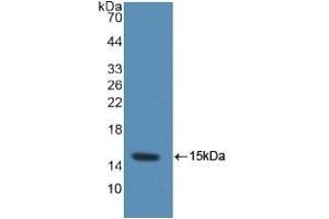 Detection of Recombinant MRP1, Rat using Polyclonal Antibody to Chemokine (C-C motif) ligand 6 (CCL6) (CCL6 antibody  (AA 21-115))
