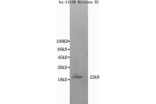 Histone Cluster 1, H1t (HIST1H1T) (AA 51-207) antibody