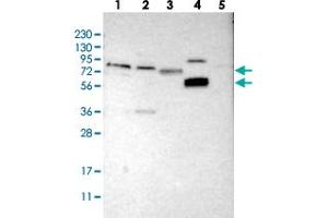 Western blot analysis of Lane 1: RT-4, Lane 2: U-251 MG, Lane 3: Human Plasma, Lane 4: Liver, Lane 5: Tonsil with FRRS1 polyclonal antibody . (Ferric-Chelate Reductase 1 (FRRS1) antibody)