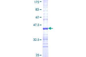 Image no. 1 for 5,10-Methenyltetrahydrofolate Synthetase (5-Formyltetrahydrofolate Cyclo-Ligase) (MTHFS) (AA 104-203) protein (GST tag) (ABIN2752863)