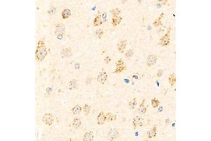 Immunohistochemistry (Paraffin-embedded Sections) (IHC (p)) image for anti-Actin Related Protein 2/3 Complex, Subunit 1B, 41kDa (ARPC1B) antibody (ABIN7072895)