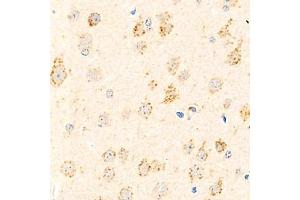 Immunohistochemistry analysis of paraffin-embedded mouse brain using,Arp2 (ABIN7072895) at dilution of 1: 800 (ARPC1B antibody)