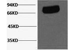 Western Blotting (WB) image for anti-Transferrin (TF) antibody (ABIN5962683) (Transferrin antibody)