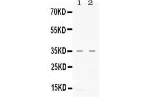 Western blot analysis of CXCL16 expression in CEM whole cell lysates ( Lane 1) and A549 whole cell lysates ( Lane 2).