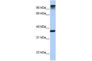 WB Suggested Anti-EPS15 Antibody Titration: 0.