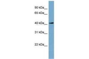 Image no. 1 for anti-Testis-Specific serine Kinase 2 (TSSK2) (AA 251-300) antibody (ABIN6741833) (TSSK2 antibody  (AA 251-300))