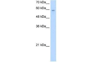 Human Jurkat; WB Suggested Anti-ARIH2 Antibody Titration: 2. (ARIH2 antibody  (N-Term))