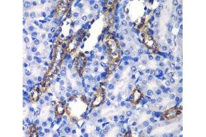 Immunohistochemistry of paraffin-embedded Rat kidney using MATK Polyclonal Antibody at dilution of 1:100 (40x lens). (MATK antibody)