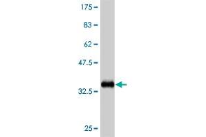 Western Blot detection against Immunogen (35. (ZIC4 antibody  (AA 1-90))