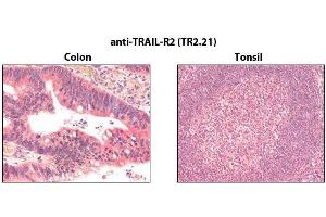 Immunohistochemistry detection of endogenous TRAIL-R2 in paraffin-embedded human carcinoma tissues (colon, tonsil) using mAb to TRAIL-R2 (TR2.