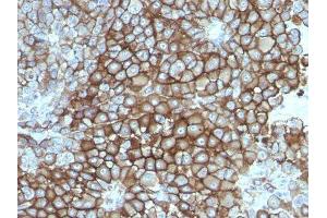 Image no. 1 for anti-Melanoma Marker antibody (ABIN6157176) (Melanoma Marker antibody)