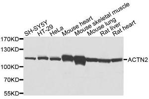 Western blot analysis of extracts of various cell lines, using ACTN2 antibody. (ACTN2 antibody  (AA 1-250))