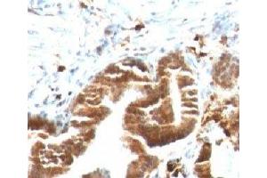IHC testing of FFPE human gallbladder with TOP1MT antibody (clone TPIMT-1).