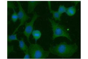 ICC/IF analysis of RAS in HeLa cells line, stained with DAPI (Blue) for nucleus staining and monoclonal anti-human RAS antibody (1:100) with goat anti-mouse IgG-Alexa fluor 488 conjugate (Green). (RAS antibody  (AA 1-186))