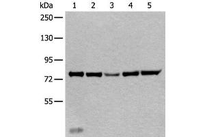 Western blot analysis of Mouse liver tissue Hela cell Human testis tissue Jurkat and HEPG2 cell lysates using ATF6B Polyclonal Antibody at dilution of 1:300 (ATF6B antibody)